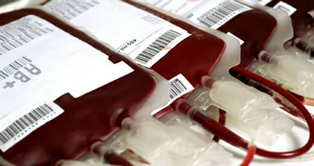 Transfuzija-krv-vrećica-krvi